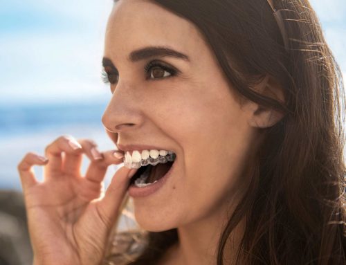 Cómo limpiar una Ortodoncia Invisible – Invisalign